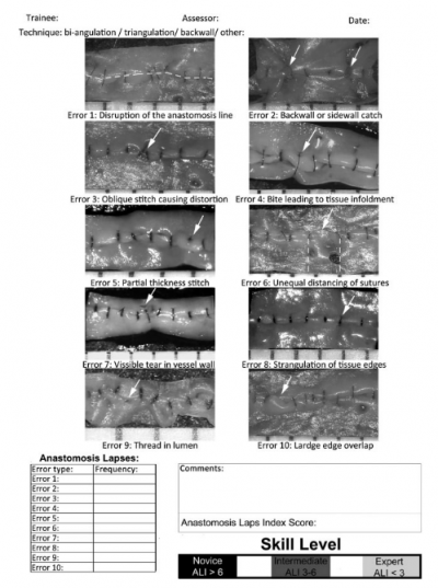 The anastomosis lapse index (ALI) assessment tool